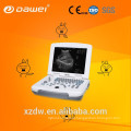 Equipamento ultra-sônico DW-500 e scanner de ultrassom usb